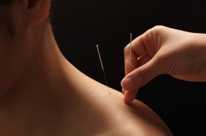 acupuncture-main