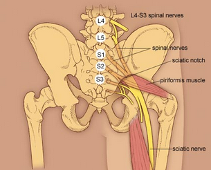 What is Sciatica? — Sobel Spine and Sports